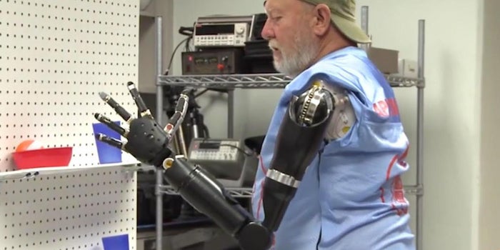 The Future Is Here: Double Amputee Is Outfitted With Mind-Controlled Prosthetic Arms