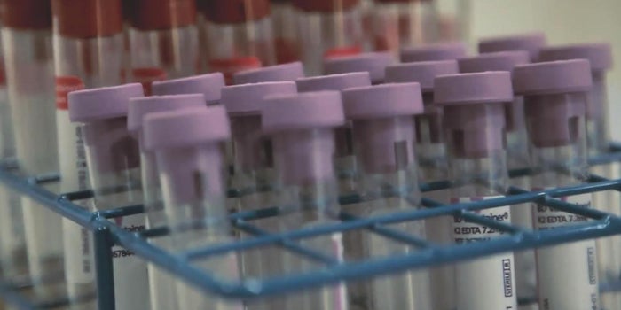 23andMe's Database of Genetic Information Is Going to Make It Lots of Money