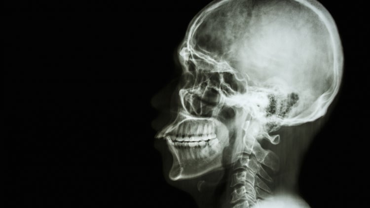 Italian Neurosurgeon Talks Of Head Transplant By 2017
