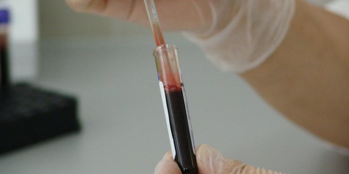 Report: Federal Regulators Find 'Serious Deficiencies' at Theranos' California Lab Facility