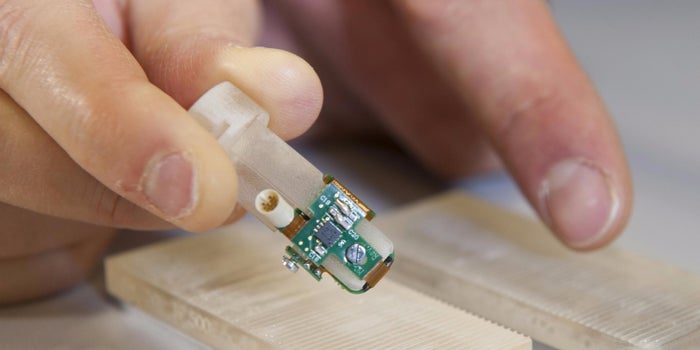 Bionic Finger Gives Amputee The Power Of Touch