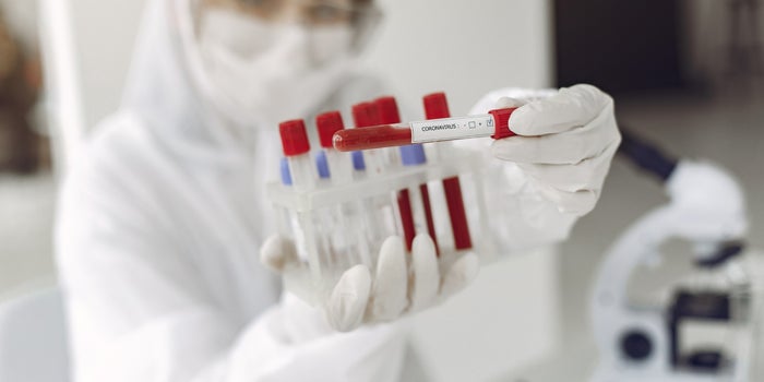 Vacuna contra Coronavirus COVID-19 en China da señales positivas: Lancet