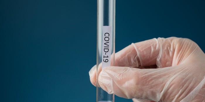 5 claves para entender el impacto real de la pandemia en el ecosistema emprendedor