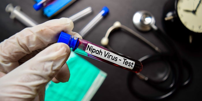 La embajada de India en México incita a no crear rumores falsos sobre el virus Nipah
