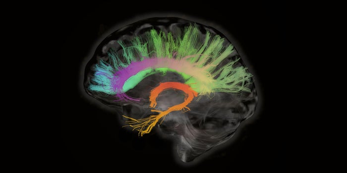 Cybin to Develop Psychedelic Therapies Using Brain Imaging