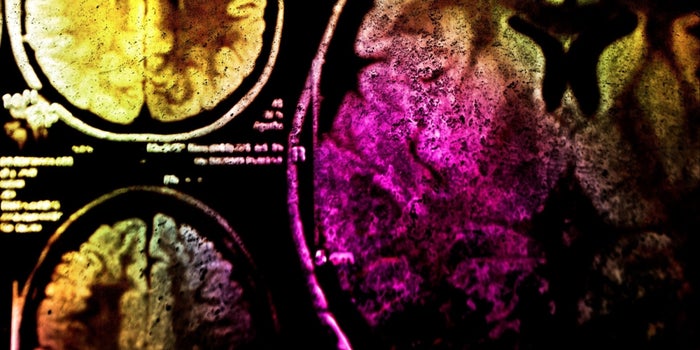¿Qué tipo de cerebro tienes?