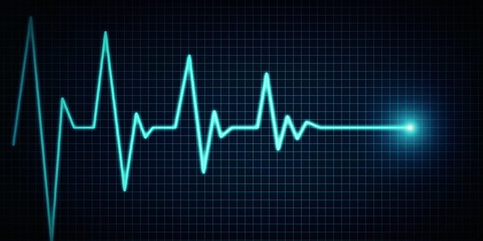3 señales de que tu startup puede morir (tomadas de empresas que sí se murieron)